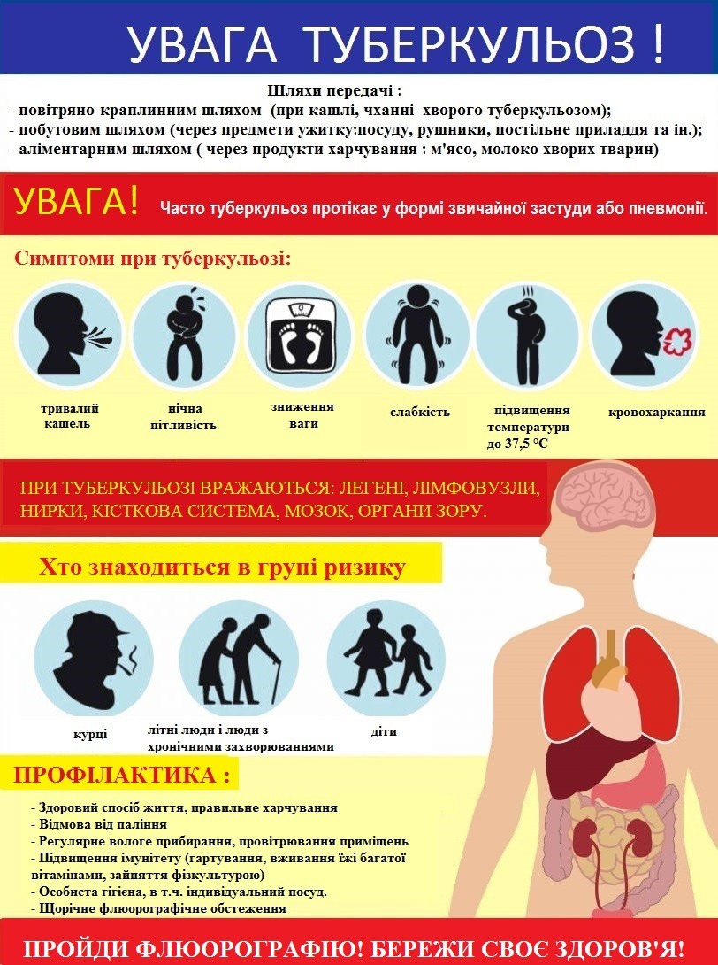 профілактика туберкульозу